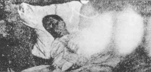 La "imnograf&iacute;a" de Baraduc. Cuando una persona muere, seg&uacute;n Baraduc, se puede capturar una masa nebulosa y amorfa en la fotograf&iacute;a.